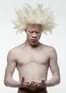 albino2